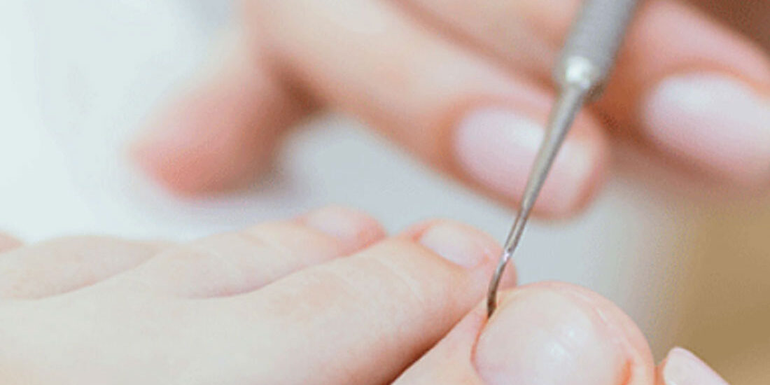 orthonuxia-upiresia-podologias