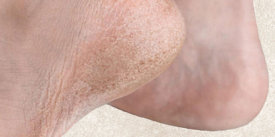 ragades_skasmenes_fternes