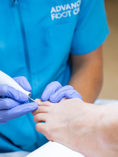 Advanced_Foot_Care_32