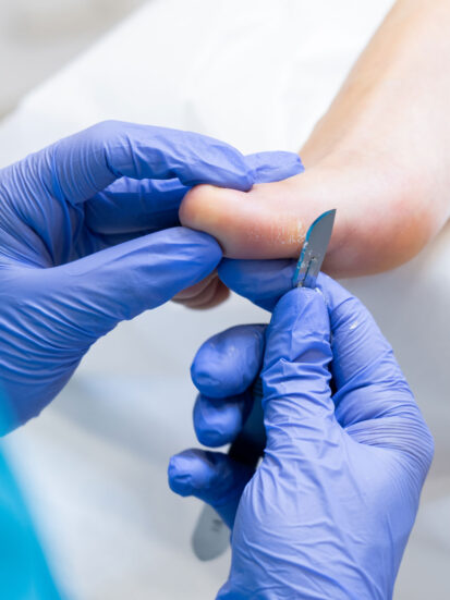 Advanced_Foot_Care_39