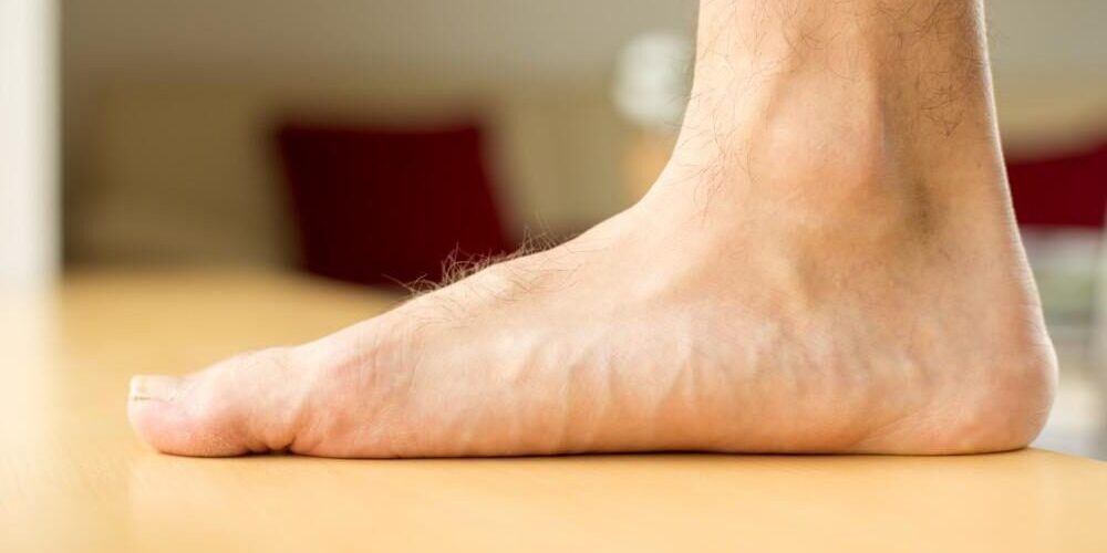 πλατυποδία