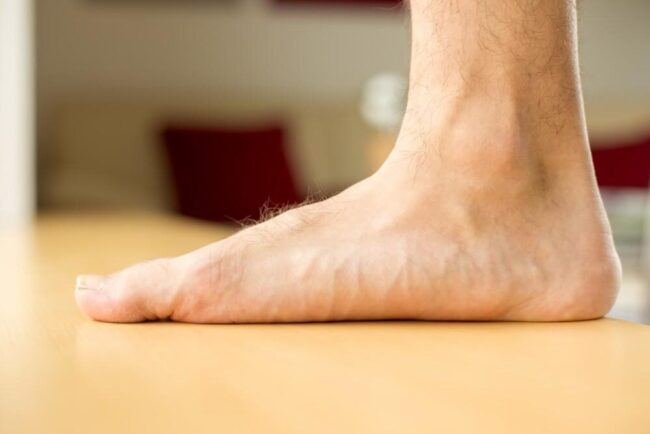 πλατυποδία